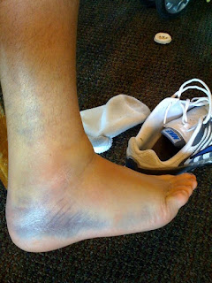 Recovered image from Good 'n Sprained!