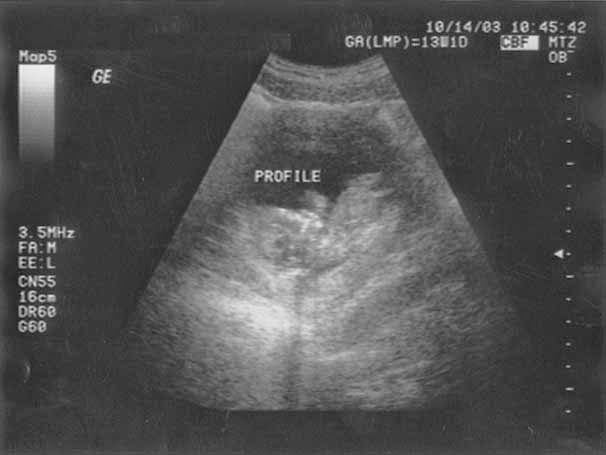 Recovered image from Annoucement